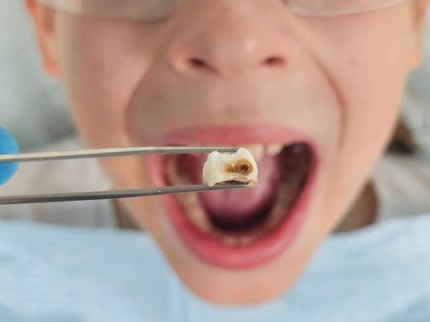 Best Pediatric Emergency Dentist in Florence, MS